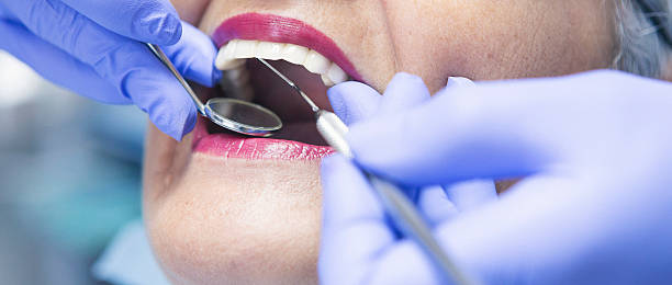 Best Knocked-Out Tooth (Avulsed Tooth) Treatment in Worthington Hills, KY